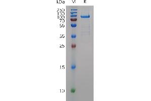 Human Protein, hFc Tag on SDS-PAGE under reducing condition. (MMP11 Protein (AA 32-488) (Fc Tag))