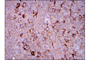 Immunohistochemistry (IHC) image for anti-Glucose-6-Phosphate Dehydrogenase (G6PD) antibody (ABIN969161)