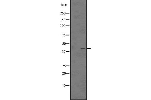 LPAR5 antibody  (Internal Region)