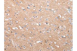 The image on the left is immunohistochemistry of paraffin-embedded Human brain tissue using ABIN7190332(COLEC12 Antibody) at dilution 1/40, on the right is treated with synthetic peptide. (COLEC12 antibody)