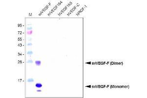 Western Blot Analysis using a Protein-A purified antibody against svVEGF-F (Bothrops Insularis). (VEGF-F / SvVEGF (AA 24-146) antibody)