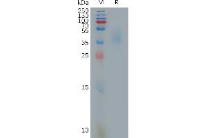 Monkeypox virus E8L Protein, His Tag on SDS-PAGE under reducing condition. (MPXV E8L (AA 1-275) protein (His tag))