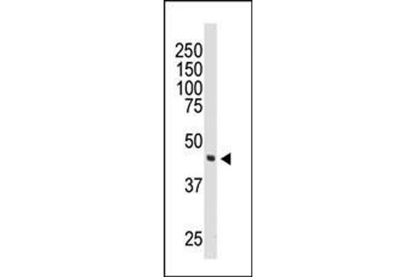 DOK2 antibody  (C-Term)