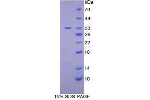 SDS-PAGE (SDS) image for Protein Kinase C, epsilon (PRKCE) ELISA Kit (ABIN6574158)