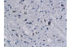 Formalin-fixed and paraffin embedded mouse brain labeled with Anti-DCX Polyclonal Antibody, Unconjugated (ABIN674184) followed by conjugation to the secondary antibody and DAB staining (Doublecortin antibody)