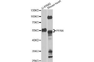 Western blot analysis of extracts of various cell lines, using PPAN Antibody. (PPAN antibody)