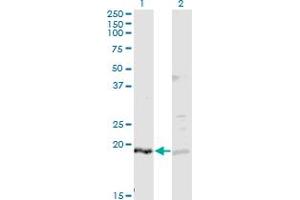 Western Blot analysis of IFNA2 expression in transfected 293T cell line by IFNA2 monoclonal antibody. (IFNA2 antibody  (AA 24-188))