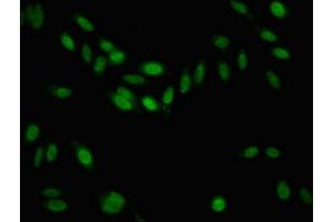 Immunofluorescent analysis of Hela cells using ABIN7158720 at dilution of 1:100 and Alexa Fluor 488-congugated AffiniPure Goat Anti-Rabbit IgG(H+L) (Kdm6b antibody  (AA 1530-1682))