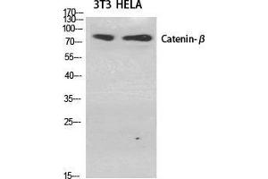 Western Blot (WB) analysis of specific cells using Catenin-beta Polyclonal Antibody. (beta Catenin antibody  (Ser29))