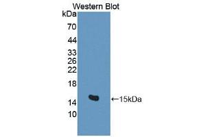 Figure. (BAMBI antibody  (AA 29-130))