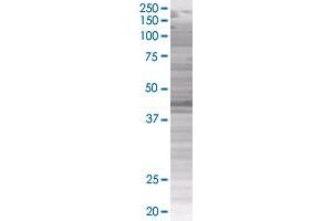 Western Blotting (WB) image for TNS1 293T Cell Transient Overexpression Lysate(Denatured) (ABIN1333762)