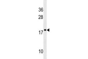 RPS17L antibody western blot analysis in NCI-H292 lysate. (RPS17L antibody  (AA 77-103))