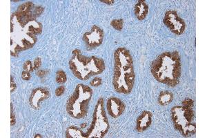 mmunohistochemistry on paraffin section of human prostate. (Prostate Specific Antigen antibody)