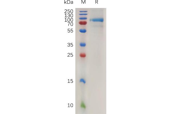 QSOX1 Protein (AA 30-706) (His tag)