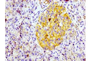 IHC image of ABIN7127288 diluted at 1:100 and staining in paraffin-embedded human pancreatic tissue performed on a Leica BondTM system. (Recombinant CD99 antibody)
