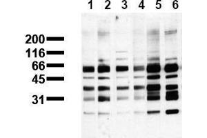 Western Blotting (WB) image for anti-Phosphoserine (phosphorylated) antibody (ABIN126863) (Phosphoserine antibody  (phosphorylated))