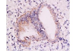 Formalin-fixed and paraffin embedded: human endometrium tissue labeled with Anti-RAR-alpha Polyclonal Antibody, Unconjugated at 1:200, followed by conjugation to the secondary antibody and DAB staining (Retinoic Acid Receptor alpha antibody  (AA 361-462))