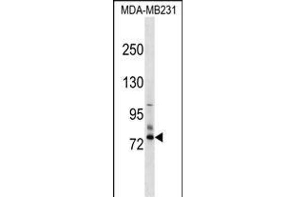 SCNN1D antibody  (N-Term)