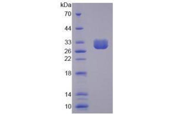 CLCA1 Protein (AA 416-670) (His tag)