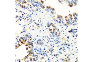 Immunohistochemistry of paraffin-embedded mouse lung using SERPINA7 antibody. (SERPINA7 antibody)