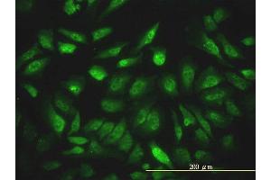 Immunofluorescence of monoclonal antibody to NCOA4 on HeLa cell. (NCOA4 antibody  (AA 1-575))