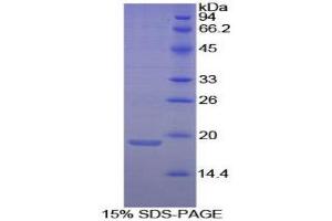 SDS-PAGE (SDS) image for Annexin A4 (ANXA4) (AA 3-156) protein (His tag) (ABIN1098862) (Annexin IV Protein (AA 3-156) (His tag))