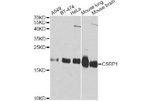 Western blot analysis of extracts of various cell lines, using CSRP1 Antibody (ABIN5970430) at 1/1000 dilution. (CSRP1 antibody)