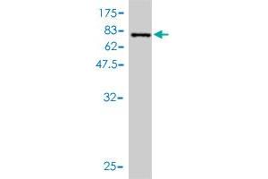 Western Blot detection against Immunogen (72. (Retinoblastoma Binding Protein 4 antibody  (AA 1-425))