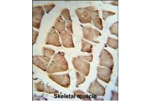 GSN Antibody (C-term) (R) IHC analysis in formalin fixed and paraffin embedded human Skeletal muscle tissue followed by peroxidase conjugation of the secondary antibody and DAB staining. (Gelsolin antibody  (C-Term))