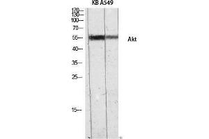 Western Blotting (WB) image for anti-V-Akt Murine Thymoma Viral Oncogene Homolog 1 (AKT1) (Internal Region) antibody (ABIN6283882) (AKT1 antibody  (Internal Region))