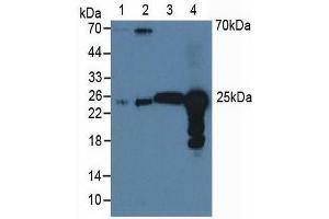 Western blot analysis of (1) Human A549 Cells, (2) Human HeLa cells, (3) Bovine Liver Tissue and (4) Bovine Lung Tissue. (Peroxiredoxin 6 antibody  (AA 1-224))