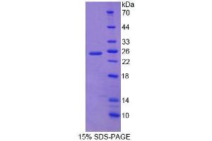 SDS-PAGE analysis of Mouse DTNBP1 Protein. (DTNBP1 Protein)