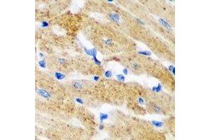 Immunohistochemical analysis of HNMT staining in mouse heart formalin fixed paraffin embedded tissue section. (HNMT antibody)