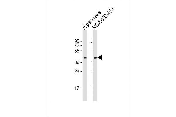 HHLA2 antibody  (N-Term)