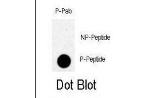 Dot Blot (DB) image for anti-TBK (pSer172) antibody (ABIN3001894) (TBK (pSer172) antibody)