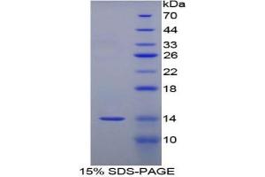 SDS-PAGE (SDS) image for Serum Amyloid A (SAA) ELISA Kit (ABIN6574095)