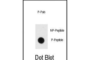 Dot blot analysis of anti-Phospho-MBP- Antibody (ABIN389939 and ABIN2839752) on nitrocellulose membrane. (MBP antibody  (pTyr203))
