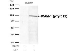 Western blot analysis of extracts from C2C12 cells, treated with starve or calf intestinal phosphatase (CIP), using ICAM-1 (Phospho-Tyr512) Antibody. (ICAM1 antibody  (pTyr512))