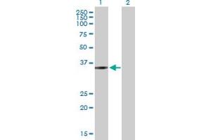 Western Blot analysis of ZMYND12 expression in transfected 293T cell line by ZMYND12 MaxPab polyclonal antibody. (ZMYND12 antibody  (AA 1-365))