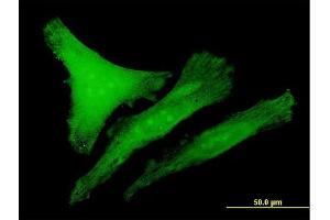 Immunofluorescence of purified MaxPab antibody to CDKN1B on HeLa cell. (CDKN1B antibody  (AA 1-198))