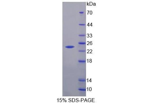 HPCAL4 Protein