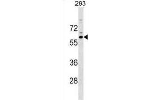 Western Blotting (WB) image for anti-RasGEF Domain Family, Member 1C (RASGEF1C) antibody (ABIN2999747) (RASGEF1C antibody)