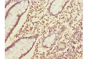 Immunohistochemistry of paraffin-embedded human small intestine tissue using ABIN7156265 at dilution of 1:100 (IKbIP antibody  (AA 121-350))