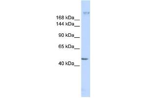 WB Suggested Anti-FER1L3 Antibody Titration:  0. (Myoferlin antibody  (C-Term))