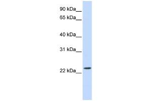 WB Suggested Anti-SCAND2 Antibody Titration: 0. (SCAND2 antibody  (Middle Region))