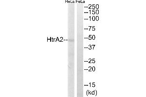 Immunohistochemistry analysis of paraffin-embedded human colon carcinoma tissue using HtrA2(Ab-142) antibody. (HTRA2 antibody  (Ser142))