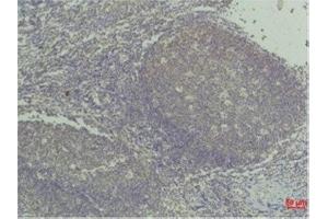 Immunohistochemistry (IHC) analysis of paraffin-embedded Human Tonsil Tissue using TNF a Mouse Monoclonal Antibody diluted at 1:50. (TNF alpha antibody)