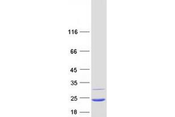 MRPL12 Protein (Myc-DYKDDDDK Tag)