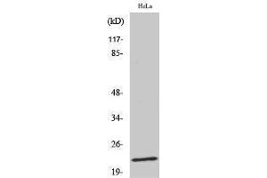 Western Blotting (WB) image for anti-Caveolin 1, Caveolae Protein, 22kDa (CAV1) (pTyr14) antibody (ABIN3172872) (Caveolin-1 antibody  (pTyr14))