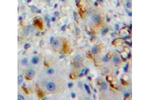 IHC-P analysis of Liver tissue, with DAB staining. (Fc gamma RII (CD32) (AA 47-285) antibody)